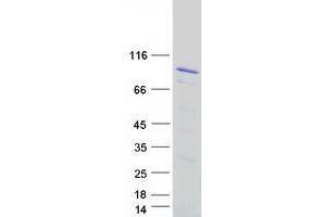 Validation with Western Blot (ZYX Protein (Transcript Variant 1) (Myc-DYKDDDDK Tag))