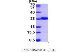 SDS-PAGE (SDS) image for Glutathione S-Transferase mu 2 (Muscle) (GSTM2) (AA 1-218) protein (His tag) (ABIN667223) (GSTM2 Protein (AA 1-218) (His tag))