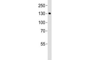 Western blot analysis of lysate from mouse bladder tissue lysate using MLCK antibody diluted at 1:1000.