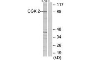 Western blot analysis of extracts from HuvEc cells, using CGK 2 Antibody. (PRKG2 antibody  (AA 391-440))