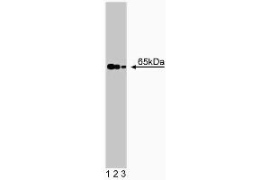 Western blot analysis of NMT-2 on human endothelial lysate. (NMT2 antibody  (AA 10-119))