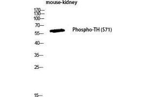 Western Blot (WB) analysis of Mouse Kidney lysis using Phospho-TH (S71) antibody. (TH antibody  (pSer71))