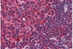 Human Colon, Lymphoid Follicle (formalin-fixed, paraffin-embedded) stained with PRDM1 antibody ABIN351445 at 3 ug/ml followed by biotinylated goat anti-rabbit IgG secondary antibody ABIN481713, alkaline phosphatase-streptavidin and chromogen. (PRDM1 antibody  (C-Term))