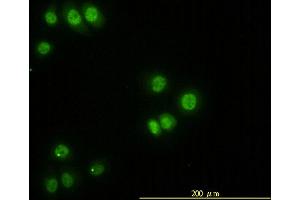 Immunofluorescence of monoclonal antibody to STK38 on HeLa cell. (STK38 antibody  (AA 1-465))