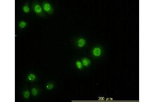 Immunofluorescence of monoclonal antibody to STK38 on HeLa cell.