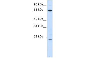 WB Suggested Anti-NIP7 Antibody Titration:  0. (NIP7 antibody  (Middle Region))