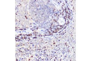 Immunohistochemistry of paraffin-embedded rat spleen using CTIP2/BCL11B Rabbit pAb (ABIN7265808) at dilution of 1:50 (40x lens). (BCL11B antibody)