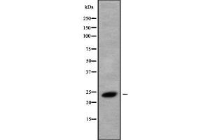 Western blot analysis of RAB8B using HeLa whole cell lysates (RAB8B antibody  (C-Term))