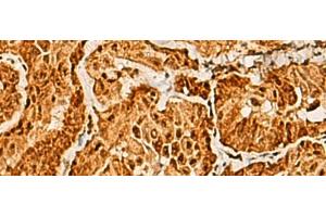 SAP30BP antibody