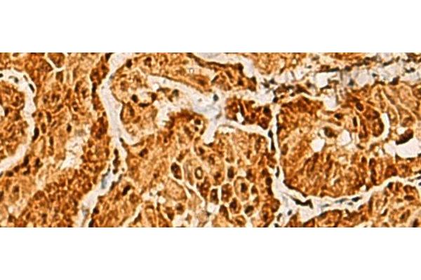 SAP30BP antibody