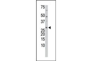 The anti-TrxL Pab (ABIN388135 and ABIN2846378) is used in Western blot to detect TrxL in HL-60 cell lysate. (TXNL1 antibody  (C-Term, Trp32))