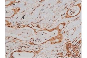 Immunohistochemistry (IHC) image for anti-Microtubule-Associated Protein tau (MAPT) (pSer262) antibody (ABIN6256228)