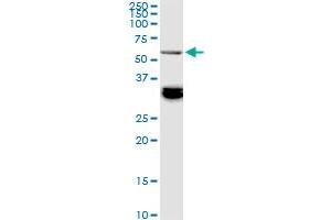 BAIAP2L1 monoclonal antibody (M01), clone 2A4. (BAIAP2L1 antibody  (AA 398-511))
