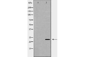 Western blot analysis of MCF7 cell lysate, using CLDN1 Antibody.