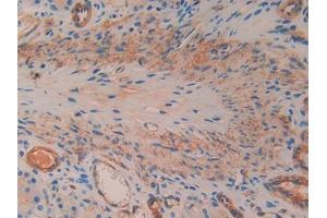 DAB staining on IHC-P; Samples: Rat Stomach Tissue (SMAD1 antibody  (AA 273-468))