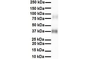 WB Suggested Anti-RNF2 antibody Titration: 1 ug/mL Sample Type: Human Heart (RNF2 antibody  (Middle Region))