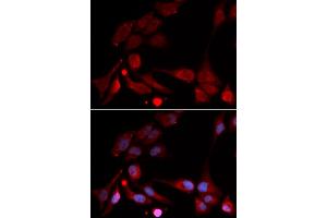 Immunofluorescence analysis of U2OS cells using APBB1 antibody (ABIN5971004). (FE65 antibody)