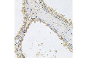 Immunohistochemistry of paraffin-embedded human prostate using POMGNT1 antibody. (POMGNT1 antibody)