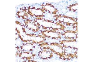 Immunohistochemistry of paraffin-embedded mouse kidney using TNFRSF10D Rabbit pAb (ABIN6127587, ABIN6149306, ABIN6149308 and ABIN6221737) at dilution of 1:100 (40x lens). (DcR2 antibody  (AA 257-386))