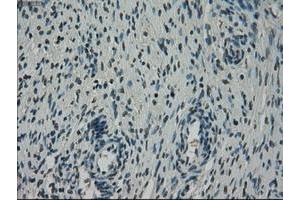 Image no. 1 for anti-NIMA (Never in Mitosis Gene A)-Related Kinase 6 (NEK6) antibody (ABIN1499686) (NEK6 antibody)