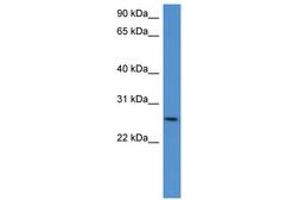 Image no. 1 for anti-Chondrolectin (CHODL) (AA 161-210) antibody (ABIN6746374) (CHODL antibody  (AA 161-210))