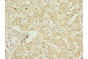 Immunohistochemistry of paraffin-embedded human liver tissue using ABIN7154146 at dilution of 1:100 (GLYCTK antibody  (AA 284-523))