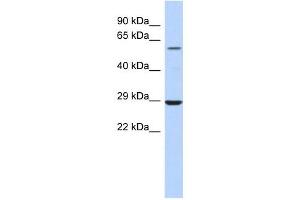 LPCAT1 antibody used at 1 ug/ml to detect target protein. (LPCAT1 antibody  (Middle Region))
