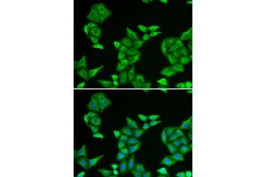 Immunofluorescence analysis of HeLa cells using COX5A antibody (ABIN5973837).