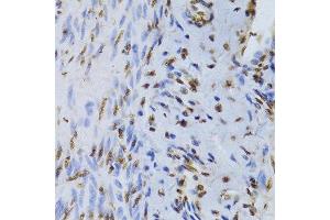 Immunohistochemistry of paraffin-embedded human adenomyosis using XRCC5 Antibody. (XRCC5 antibody  (AA 543-732))