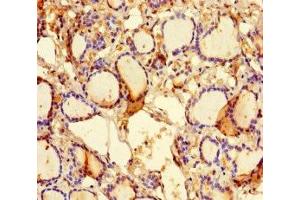 Immunohistochemistry of paraffin-embedded human thyroid tissue using ABIN7157298 at dilution of 1:100