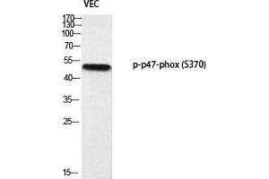 Western Blot (WB) analysis of VEC using p-p47-phox (S370) antibody. (NCF1 antibody  (pSer370))