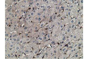 Immunohistochemical staining of paraffin-embedded Human liver tissue using anti-RBP1 mouse monoclonal antibody. (RBP1 antibody)