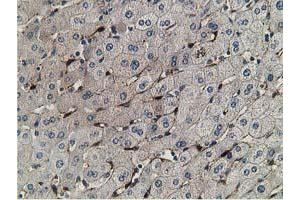 Immunohistochemical staining of paraffin-embedded Human liver tissue using anti-RBP1 mouse monoclonal antibody.