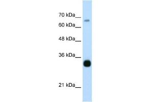THOC3 antibody used at 0.