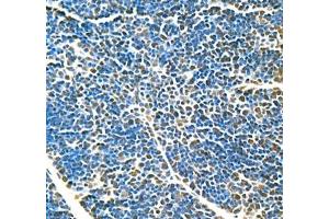 Immunohistochemistry (Paraffin-embedded Sections) (IHC (p)) image for anti-Topoisomerase (DNA) II alpha 170kDa (TOP2A) antibody (ABIN7075937)
