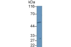 Detection of b4GALNT2 in Hela cell lysate using Monoclonal Antibody to Beta-1,4-N-Acetyl Galactosaminyl Transferase 2 (b4GALNT2) (B4GALNT2 antibody  (AA 324-566))