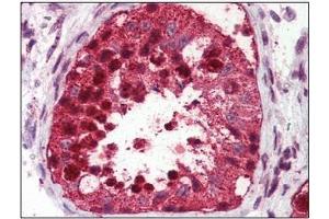 Immunohistochemistry: USP2 antibody staining of Formalin-Fixed, Paraffin-Embedded Human Testis. (USP2 antibody  (C-Term))