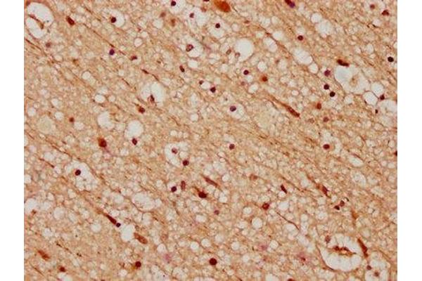 CELF4 antibody  (AA 120-236)