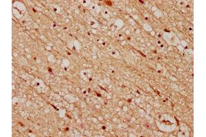 IHC image of ABIN7148739 diluted at 1:200 and staining in paraffin-embedded human brain tissue performed on a Leica BondTM system. (CELF4 antibody  (AA 120-236))