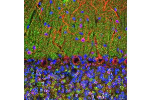 Confocal image of adult rat cerebellum stained with VILIP / VSNL1 antibody (green), chicken polyclonal antibody to MAP2(red) and DNA (blue). (VSNL1 antibody)