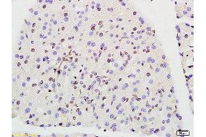 Formalin-fixed and paraffin embedded rat pancreas labeled with Anti-Prohibitin Polyclonal Antibody, Unconjugated (ABIN686692) at 1:200 followed by conjugation to the secondary antibody and DAB staining. (Prohibitin antibody  (AA 171-272))