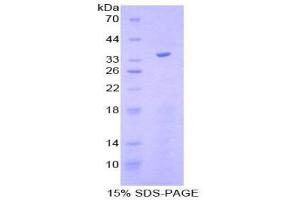 SDS-PAGE (SDS) image for Kruppel-Like Factor 4 (Gut) (KLF4) (AA 187-474) protein (His tag) (ABIN1879715) (KLF4 Protein (AA 187-474) (His tag))