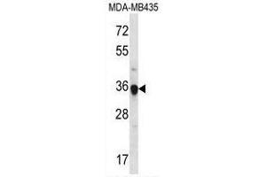 Western blot analysis in MDA-MB435 cell line lysates (35ug/lane) using FGL1 Antibody (C-term). (FGL1 antibody  (C-Term))