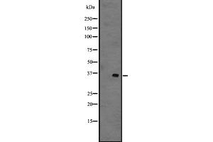 Western blot analysis of GPR141 expression in 721_B whole cell lysate ,The lane on the left is treated with the antigen-specific peptide. (GPR141 antibody)