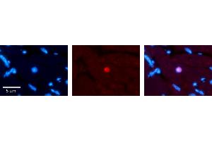 Rabbit Anti-RING1 Antibody Catalog Number: ARP33228_P050 Formalin Fixed Paraffin Embedded Tissue: Human heart Tissue Observed Staining: Nucleus Primary Antibody Concentration: 1:100 Other Working Concentrations: N/A Secondary Antibody: Donkey anti-Rabbit-Cy3 Secondary Antibody Concentration: 1:200 Magnification: 20X Exposure Time: 0. (RING1 antibody  (Middle Region))