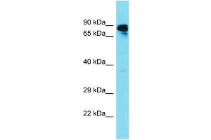 Host: Rabbit Target Name: GBP6 Sample Type: Fetal Liver lysates Antibody Dilution: 1. (GBP6 antibody  (N-Term))
