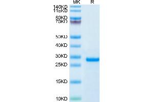 SDS-PAGE (SDS) image for WAP Four-Disulfide Core Domain 1 (WFDC1) (AA 32-220) protein (His tag) (ABIN7275483)