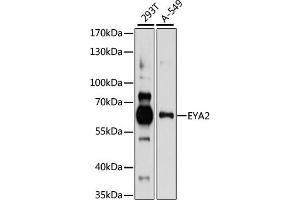 Western blot analysis of extracts of various cell lines, using EY antibody (ABIN7267072) at 1:1000 dilution. (EYA2 antibody  (AA 300-400))