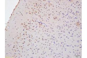 Formalin-fixed and paraffin embedded rat brain labeled with Anti-Myelin PLP Polyclonal Antibody, Unconjugated  at 1:200 followed by conjugation to the secondary antibody and DAB staining (PLP1 antibody  (AA 21-120))