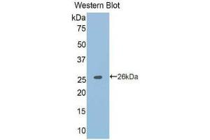 Western Blotting (WB) image for anti-Tumor Necrosis Factor Receptor Superfamily, Member 21 (TNFRSF21) (AA 406-605) antibody (ABIN1176216) (TNFRSF21 antibody  (AA 406-605))